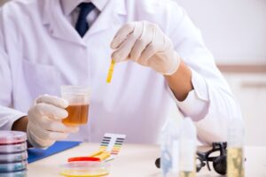 Urine test for alcohol use